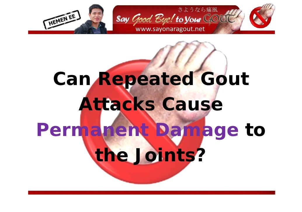 Can Repeated Gout Attacks Cause Permanent Damage to the Joints