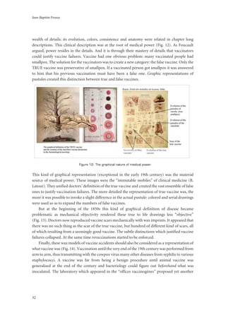Jean-Baptiste Fressoz
32
wealth of details: its evolution, colors, consistence and anatomy were related in chapter long
descriptions. This clinical description was at the root of medical power (Fig. 12). As Foucault
argued, power resides in the details. And it is through their mastery of details that vaccinators
could justify vaccine failures. Vaccine had one obvious problem: many vaccinated people had
smallpox. The solution for the vaccinators was to create a new category: the false vaccine. Only the
TRUE vaccine was preservative of smallpox. If a vaccinated person got smallpox it was answered
to him that his previous vaccination must have been a false one. Graphic representations of
pustules created this distinction between true and false vaccines.
Figure 12: The graphical nature of medical power.
This kind of graphical representation (exceptional in the early 19th century) was the material
source of medical power. These images were the “immutable mobiles” of clinical medicine (B.
Latour). They unified doctors’ definition of the true vaccine and created the vast ensemble of false
ones to justify vaccination failures. The more detailed the representation of true vaccine was, the
more it was possible to invoke a slight difference in the actual pustule: colored and serial drawings
were used so as to expand the numbers of false vaccines.
But at the beginning of the 1850s this kind of graphical definition of disease became
problematic as mechanical objectivity rendered these true to life drawings less “objective”
(Fig. 13). Doctors now reproduced vaccine scars mechanically with wax imprints. It appeared that
there was no such thing as the scar of the true vaccine, but hundred of different kind of scars, all
of which resulting from a seemingly good vaccine. The subtle distinctions which justified vaccine
failures collapsed. At the same time revaccinations started to be enforced.
Finally, these wax models of vaccine accidents should also be considered as a representation of
what vaccine was (Fig. 14). Vaccination until the very end of the 19th century was performed from
arm to arm, thus transmitting with the cowpox virus many other diseases from syphilis to various
staphylococci. A vaccine was far from being a benign procedure until animal vaccine was
generalised at the end of the century and bacteriology could figure out beforehand what was
inoculated. The laboratory which appeared in the “offices vaccinogènes” proposed yet another
 