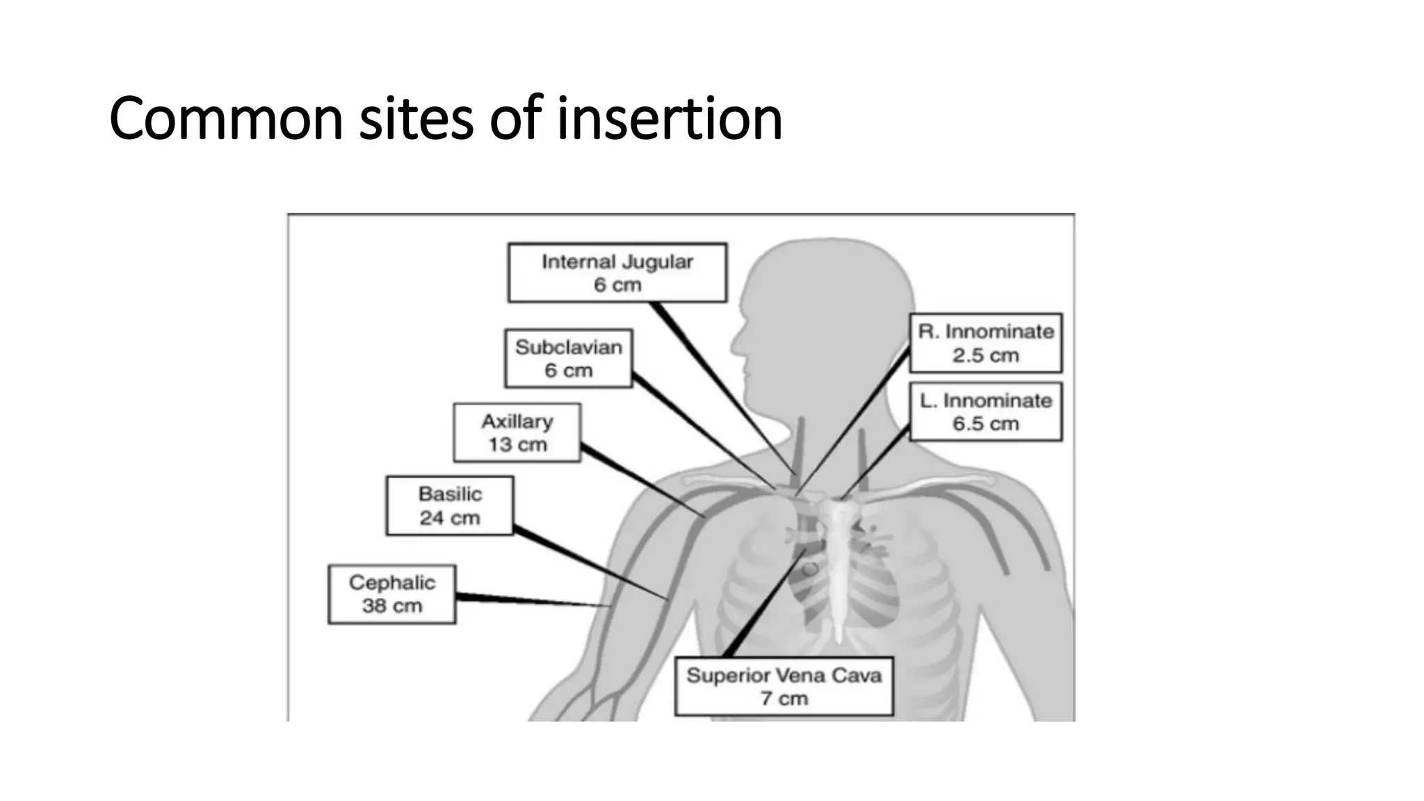 Common sites of insertion
 