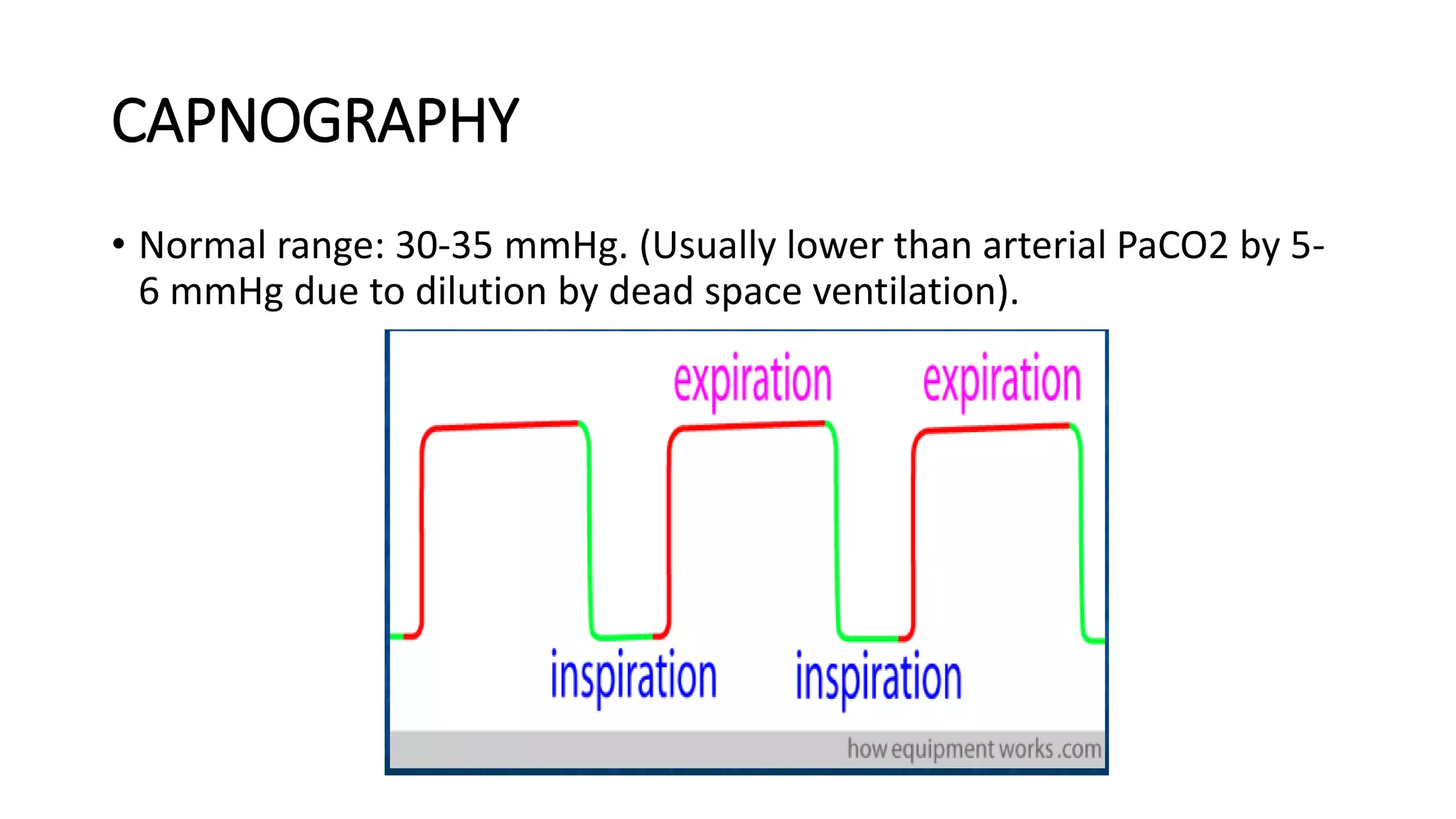 CAPNOGRAPHY
• Normal range: 30-35 mmHg. (Usually lower than arterial PaCO2 by 5-
6 mmHg due to dilution by dead space ventilation).
 
