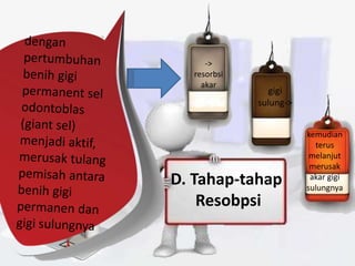 D. Tahap-tahap
Resobpsi
->
resorbsi
akar
gigi
sulung->
kemudian
terus
melanjut
merusak
akar gigi
sulungnya
 