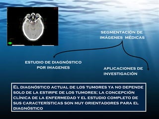 segmentación de
imágenes médicas
aplicaciones de
investigación
El diagnóstico actual de los tumores ya no depende
solo de la estirpe de los tumores; la concepción
clínica de la enfermedad y el estudio completo de
sus características son muy orientadores para el
diagnóstico
estudio de diagnóstico
por imagenes
 