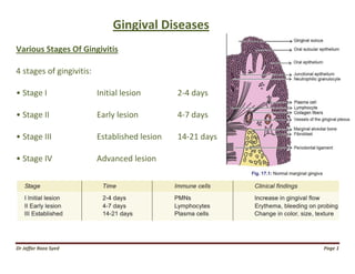 Dr Jaffar Raza Syed
Gingival Diseases
Various Stages Of Gingivitis
4 stages of gingivitis:
• Stage I Initial lesion
• Stage II Early lesion
• Stage III Established lesion
• Stage IV Advanced lesion
Gingival Diseases
Initial lesion 2-4 days
Early lesion 4-7 days
Established lesion 14-21 days
dvanced lesion
Page 1
 