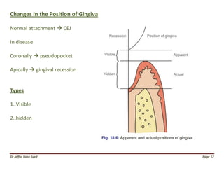 019.gingival diseases | PDF