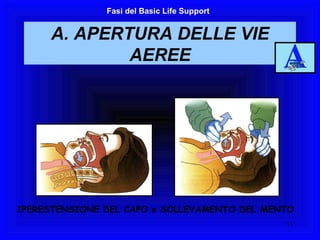 A. APERTURA DELLE VIE AEREE Fasi del Basic Life Support IPERESTENSIONE DEL CAPO e SOLLEVAMENTO DEL MENTO 
