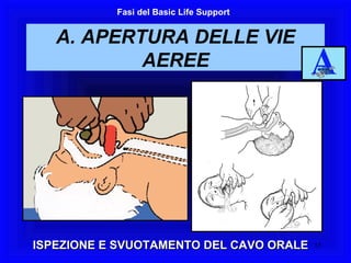 ISPEZIONE E SVUOTAMENTO DEL CAVO ORALE A. APERTURA DELLE VIE AEREE Fasi del Basic Life Support 