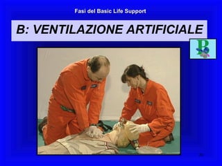 Fasi del Basic Life Support B: VENTILAZIONE ARTIFICIALE 