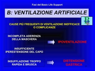 CAUSE PIÚ FREQUENTI DI VENTILAZIONE INEFFICACE O COMPLICANZE INCOMPLETA ADERENZA DELLA MASCHERA INSUFFICIENTE IPERESTENSIONE DEL CAPO IPOVENTILAZIONE INSUFFLAZIONE TROPPO RAPIDA E BRUSCA DISTENSIONE GASTRICA Fasi del Basic Life Support B: VENTILAZIONE ARTIFICIALE 