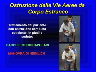 Trattamento del paziente con ostruzione completa cosciente, in piedi o seduto: MANOVRA DI HEIMLICH PACCHE INTERSCAPOLARI Ostruzione delle Vie Aeree da  Corpo Estraneo 