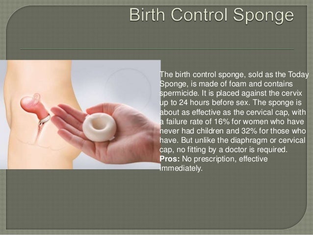 How Effective Is A Sponge? : Birth Control Sponge: Use, Benefits, Risks ...