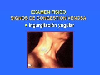 Valoración cardiovascularMétodos:Entrevista es la fase mas importante.Examen físico. Se realiza según procedimiento clásico de exploración: - inspección.                                             - palpación.                                             - percusión.                                             - auscultación.