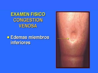 Valoración cardiovascularlas prioridades en la inspección son: observar el aspecto general. Peso, aspecto, color de la piel.Explorar los lechos ungueales y de las extremidades. En busca de reducción  en la perfusión sanguínea.