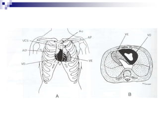 Evaluación del relleno capilar: