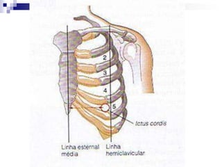 Com especial atenção à regiões ilustradasInspeçãoObservar a região precordial: