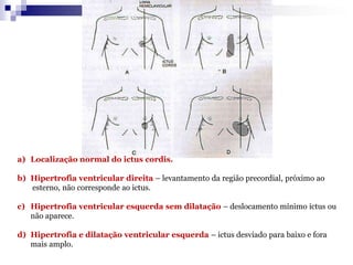 Pulsações epigástricas 
