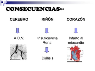 duração – dois terços iniciais da sístole