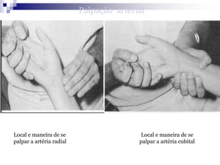 Valoración Cardiovascular Valoración de los ruidos cardiacos normales:Los ruidos cardiacos  primer ruido (S1) y segundo ruido (S2)Primer ruido ocurre con el cierre de las válvulas tricúspide y mitral. Se cierran al principio de la sístole.
