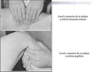 Valoración cardiovascularSitios de auscultaciónFoco  aórtico: segundo espacio intercostal derecho.Foco pulmonar: segundo espacio intercostal izquierdo.Foco tricúspide:  4to a 5to espacio intercostal  con línea media paraesternal izquierda.Foco mitral:  5to EII con línea media  clavicular izq.