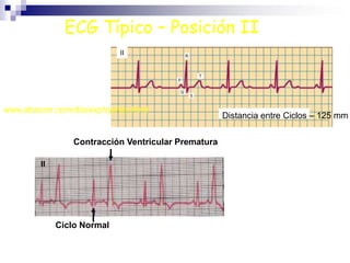 TRATAMIENTOMedidas FarmacológicasInhibidores de la enzima de conversión de la angiotensina (IECA).Estimuladores de los receptores alfa centrales. Bloqueantes alfaadrenérgicos.Medidas No FarmacológicasAumento de la actividad física. Dejar de fumar para evitar el riesgo de  infarto de miocardio.