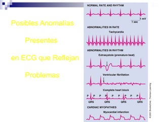 ¿CÓMO SE MIDE LA PRESIÓN ARTERIAL?La medición de la P.A. es hecha de manera indirecta y se realiza sólo con aparatos especialmente diseñados y calibrados para tal fin.Esfigmomanómetro de mercurioportátil tipo “Caimán”