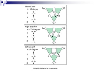 Instrumento validadorecomendado por la OMS Patrón de referenciaESFIGMOMANÓMETRO DE MERCURIO
