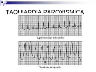 Tipos de Presurómetros utilizados corrientementeEsfigmomanómetro de columna de mercurioEsfigmomanómetro digitalCalibración cada 3 mesesOtros no comúnmenteutilizados:Por oscilometría
