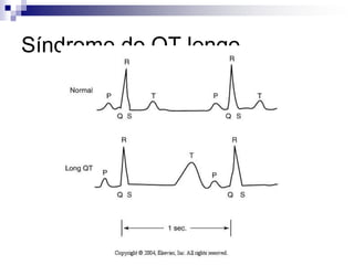 Controla el flujo de aire a la cámaraBombea  aire a la cámaraPERILLA DE INSUFLACION Y VALVULA