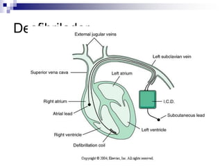 Pressão de Pulso e MédiaPressão de pulsoPressão arterial média