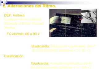  PULSOSDevem ser analisados: