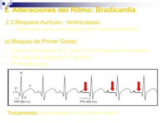 PulsosFrecuenciaRitmoContornoAmplitud4 = Rebotante3 = Lleno, aumentado2 = Esperado1 = Disminuido0 = AusenteSimetria