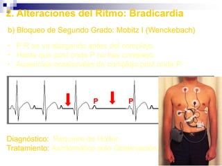 Palpação  arterialLocal e maneira de se palpara artéria temporal superficialLocal e maneira de se palpar a bifurcação da artéria carótida comum