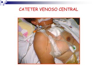 Auto-ritmicidadNódulo SAFibras internodalesNódulo AVHas de HisSistema de Purkinjewww.abacon.com/plowman/43.htmlTiempo en segundos