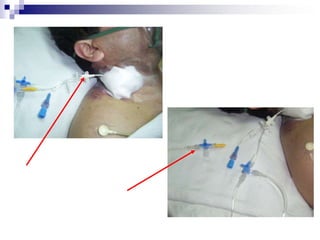 ElectrocardiogramaRegistro gráfico de los potenciales eléctricos que produce el corazón.