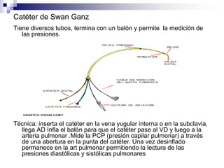 Electrocardiograma (ECG):