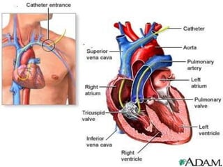 1. Electrofisiología Cardiaca.Potencial ReposoUmbral de acciónCél. Muscular-90 mV- 70 mVNodos SA y AV- 55 a -60 mV- 40 mVCaracterísticasHistológicas