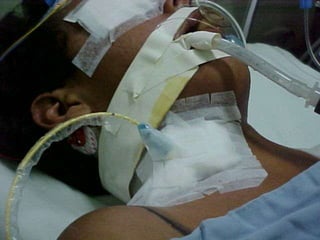 1. Electrofisiología Cardiaca.Onda P:Despolarización auricularSegmento PR: Intervalo PQImpulso desde el nódulo sinusal hasta los ventrículosComplejo QRS:Despolarización ventricularSegmento S T:Final despolarización y comienzo repolarización.Onda T:Repolarización ventricular