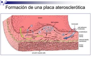    Ondas P presentes o ausentes pero sin relación con QRS