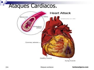    Complejos Anchos: nace en el ventrículo.   