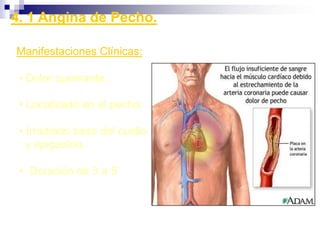 La conducción del impulso es normal.