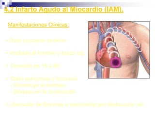    Impulso llega al NAV por 2 vías:    - Rápida de recuperación lenta    - Lenta de recuperación rápidaTratamiento:    Ablación por radiofrecuencia.