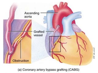    Da curva EKG de morfología normal.