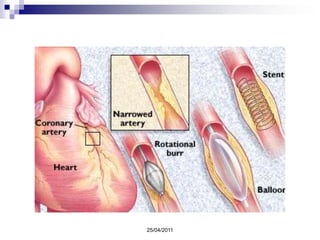  Mayor parte Asintomático
