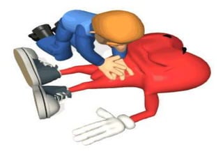 3. Alteraciones del Ritmo. Taquicardia3.7 Extrasístole Ventricular.   Complejo aberrante nacido en el Ventrículo.