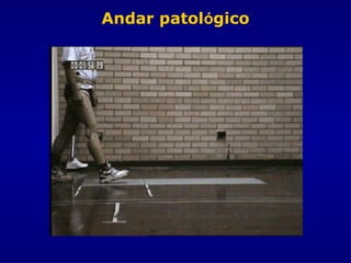 Andar patológico
 