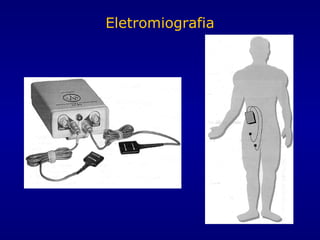 Eletromiografia
 