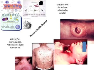 Mecanismos
de lesão e
adaptação
celular
Alterações
morfológicas,
moleculares e/ou
funcionais
 