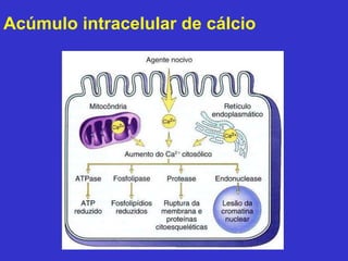 Acúmulo intracelular de cálcio 
 