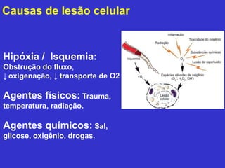 Causas de lesão celular 
Hipóxia / Isquemia: 
Obstrução do fluxo, 
↓ oxigenação, ↓ transporte de O2 
Agentes físicos: Trauma, 
temperatura, radiação. 
Agentes químicos: Sal, 
glicose, oxigênio, drogas. 
 
