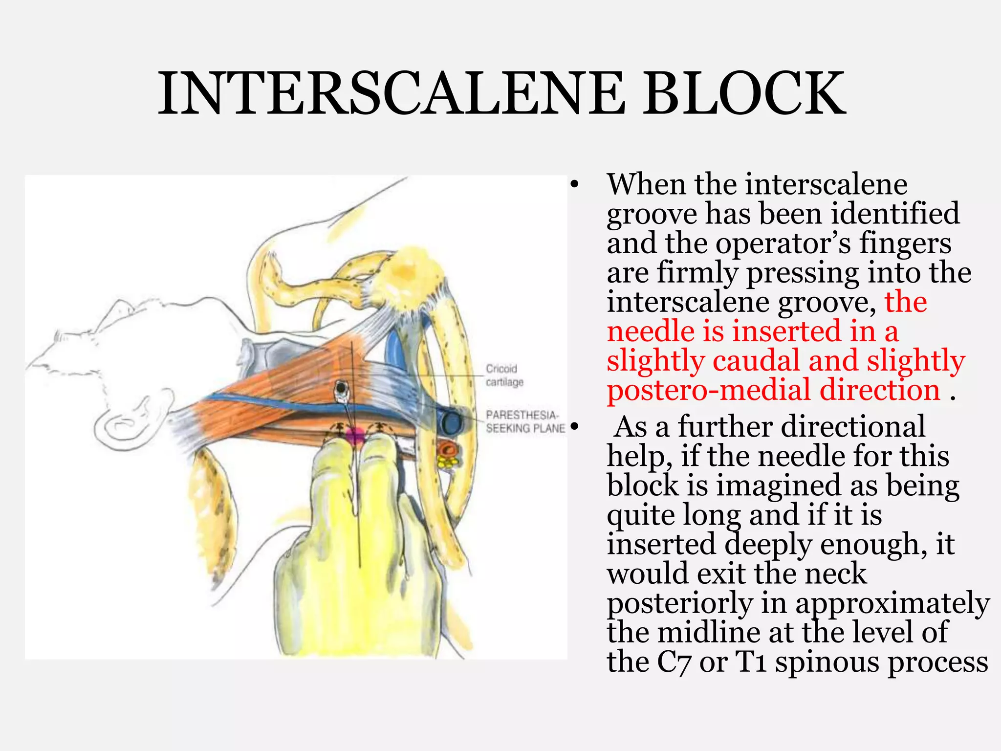 INTERSCALENE BLOCK
• When the interscalene
groove has been identified
and the operator’s fingers
are firmly pressing into the
interscalene groove, the
needle is inserted in a
slightly caudal and slightly
postero-medial direction .
• As a further directional
help, if the needle for this
block is imagined as being
quite long and if it is
inserted deeply enough, it
would exit the neck
posteriorly in approximately
the midline at the level of
the C7 or T1 spinous process
 