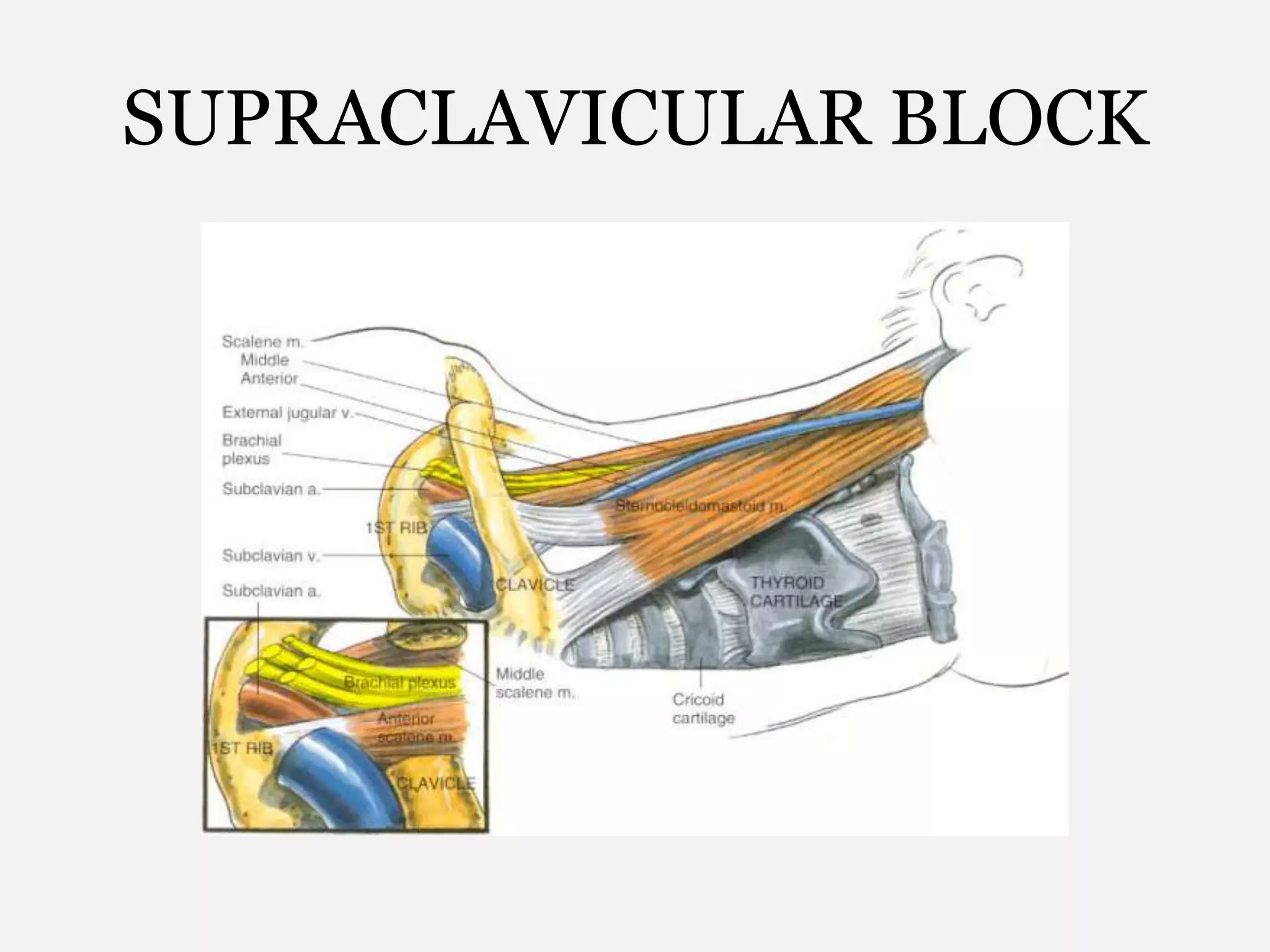 SUPRACLAVICULAR BLOCK
 